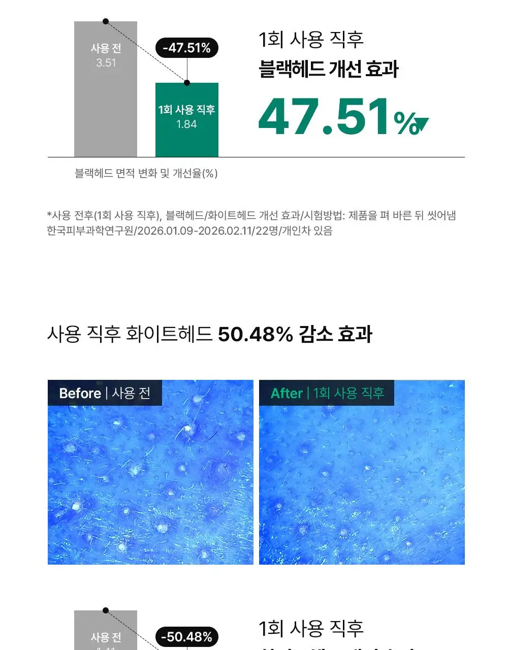 [단독기획] 동아제약 아크네 프로 겔제 30ml 기획(+3ml+크림제3ml) 상세페이지 13